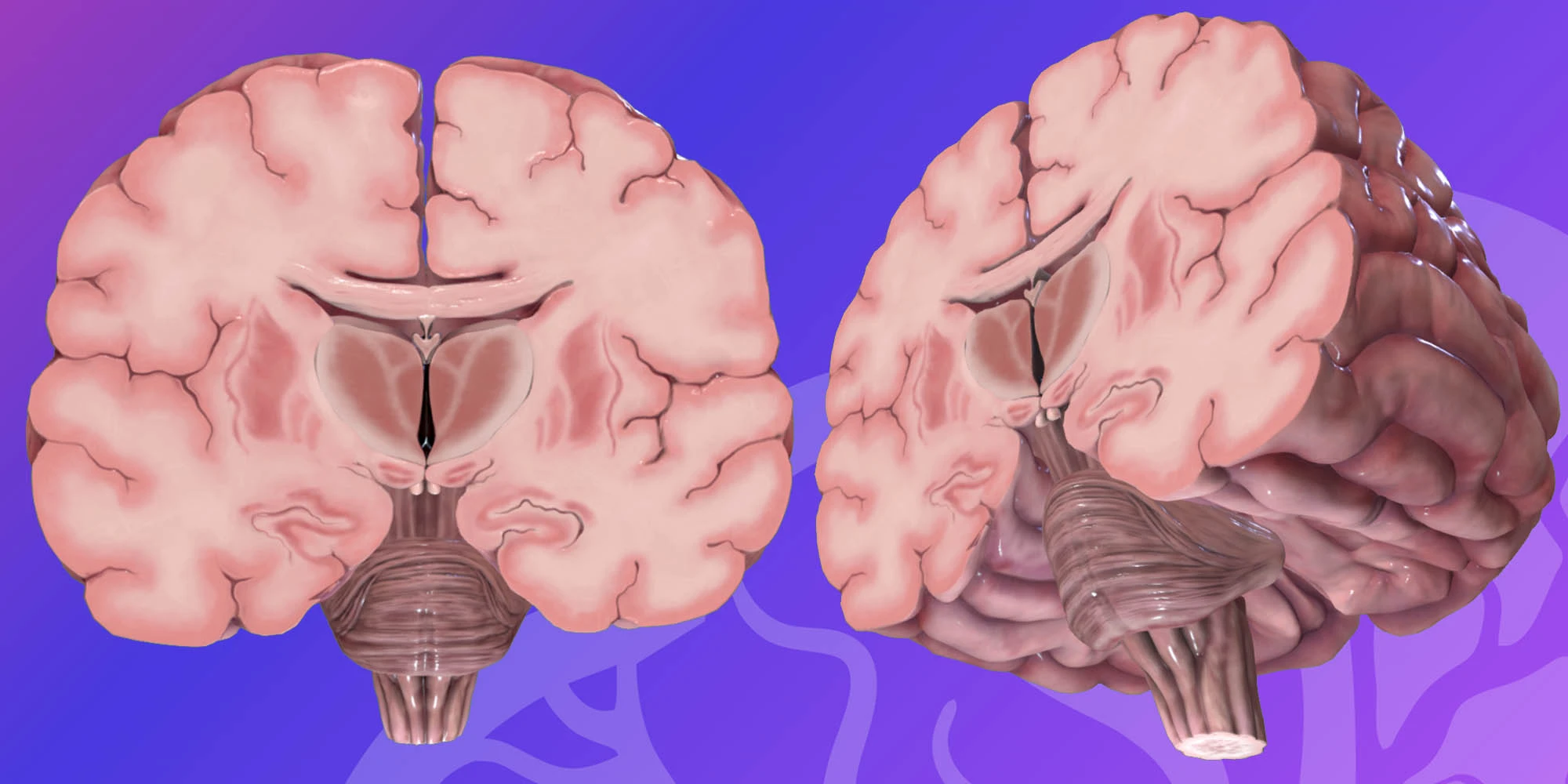 HEAD & NECK_ Brain - coronal section (At the thalamus level) image